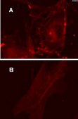 LentiBrite RFP-β-actin Lentiviral Biosensor