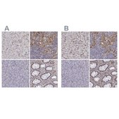Anti-CD14 antibody produced in rabbit Ab3, Prestige Antibodies® Powered by Atlas Antibodies, affinity isolated antibody, buffered aqueous glycerol solution