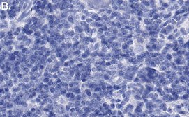 Anti-CXCL10 Antibody, clone 3F14 ZooMAb® Rabbit Monoclonal recombinant, expressed in HEK 293 cells