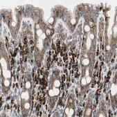 Anti-FNDC3A antibody produced in rabbit Ab1, Prestige Antibodies® Powered by Atlas Antibodies, affinity isolated antibody, buffered aqueous glycerol solution