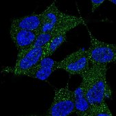 Anti-DYNC2LI1 antibody produced in rabbit Prestige Antibodies® Powered by Atlas Antibodies, affinity isolated antibody, buffered aqueous glycerol solution