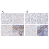 Anti-LAX1 antibody produced in rabbit Ab2, Prestige Antibodies® Powered by Atlas Antibodies, affinity isolated antibody, buffered aqueous glycerol solution