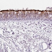 Anti-ROPN1L antibody produced in rabbit Prestige Antibodies® Powered by Atlas Antibodies, affinity isolated antibody, buffered aqueous glycerol solution