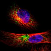 Anti-TIMM9 antibody produced in rabbit Prestige Antibodies® Powered by Atlas Antibodies, affinity isolated antibody, buffered aqueous glycerol solution