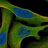Anti-MAP3K2 antibody produced in rabbit Prestige Antibodies® Powered by Atlas Antibodies, affinity isolated antibody, buffered aqueous glycerol solution