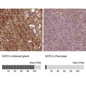 Anti-SAT2 antibody produced in rabbit Prestige Antibodies® Powered by Atlas Antibodies, affinity isolated antibody, buffered aqueous glycerol solution