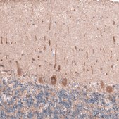 Anti-OSBP2 antibody produced in rabbit Prestige Antibodies® Powered by Atlas Antibodies, affinity isolated antibody, buffered aqueous glycerol solution