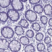 Anti-CAPS antibody produced in rabbit Prestige Antibodies® Powered by Atlas Antibodies, affinity isolated antibody, buffered aqueous glycerol solution
