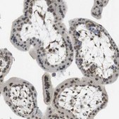 Anti-ARL6IP6 antibody produced in rabbit Prestige Antibodies® Powered by Atlas Antibodies, affinity isolated antibody, buffered aqueous glycerol solution