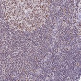 Anti-PTPN2 antibody produced in rabbit Prestige Antibodies® Powered by Atlas Antibodies, affinity isolated antibody, buffered aqueous glycerol solution
