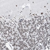 Anti-FIP1L1 antibody produced in rabbit affinity isolated antibody, buffered aqueous glycerol solution