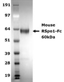 R-Spondin1 expressing 293T Cell Line The R-Spondin1-Expressing 293T cell line produces RSPO1, a critical protein used to establish 3D organoid cultures from stomach, small intestine, colon, pancreas, and liver sources.