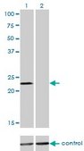 Monoclonal Anti-DENR antibody produced in mouse clone 1H3, purified immunoglobulin, buffered aqueous solution