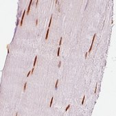 Monoclonal Anti-SIX1 antibody produced in mouse Prestige Antibodies® Powered by Atlas Antibodies, clone CL0185, purified immunoglobulin, buffered aqueous glycerol solution