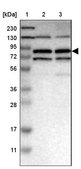 Anti-MTMR1 antibody produced in rabbit Prestige Antibodies® Powered by Atlas Antibodies, affinity isolated antibody, buffered aqueous glycerol solution