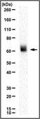 Anti-ENTPD1 Antibody from rabbit, purified by affinity chromatography