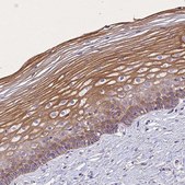 Anti-NLRP11 antibody produced in rabbit Prestige Antibodies® Powered by Atlas Antibodies, affinity isolated antibody, buffered aqueous glycerol solution