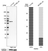 Anti-PARP2 antibody produced in rabbit Prestige Antibodies® Powered by Atlas Antibodies, affinity isolated antibody, buffered aqueous glycerol solution