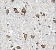 Anti-Mechano Growth Factor (MGF) Antibody from rabbit, purified by affinity chromatography