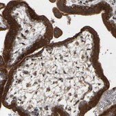 Anti-PTCD1 antibody produced in rabbit Prestige Antibodies® Powered by Atlas Antibodies, affinity isolated antibody, buffered aqueous glycerol solution