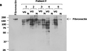 Anti-fibronectine antibody produced in rabbit affinity isolated antibody, buffered aqueous solution