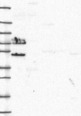 Anti-TRIM29 antibody produced in rabbit Prestige Antibodies® Powered by Atlas Antibodies, affinity isolated antibody, buffered aqueous glycerol solution