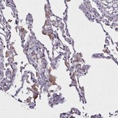 Anti-NCKAP1L antibody produced in rabbit Prestige Antibodies® Powered by Atlas Antibodies, affinity isolated antibody, buffered aqueous glycerol solution