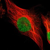 Anti-PSMC4 antibody produced in rabbit Ab1, Prestige Antibodies® Powered by Atlas Antibodies, affinity isolated antibody, buffered aqueous glycerol solution