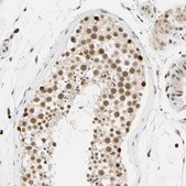 Anti-CDK7 antibody produced in rabbit Prestige Antibodies® Powered by Atlas Antibodies, affinity isolated antibody, buffered aqueous glycerol solution