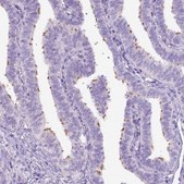 Anti-DNAH11 antibody produced in rabbit Prestige Antibodies® Powered by Atlas Antibodies, affinity isolated antibody