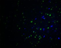 Anti-PLAGL2 antibody produced in rabbit affinity isolated antibody, buffered aqueous solution