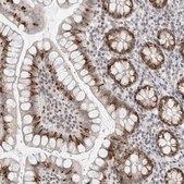 Anti-FOXK2 antibody produced in rabbit Prestige Antibodies® Powered by Atlas Antibodies, affinity isolated antibody, buffered aqueous glycerol solution