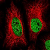 Anti-ZBTB25 antibody produced in rabbit Prestige Antibodies® Powered by Atlas Antibodies, affinity isolated antibody, buffered aqueous glycerol solution