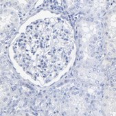 Anti-PSD3 antibody produced in rabbit Prestige Antibodies® Powered by Atlas Antibodies, affinity isolated antibody