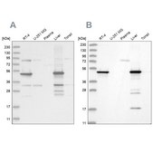 Anti-HMGCS2 antibody produced in rabbit Prestige Antibodies® Powered by Atlas Antibodies, affinity isolated antibody, buffered aqueous glycerol solution
