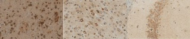 Anti-APP585C serum, from rabbit
