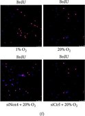 抗BrdU抗体、マウスモノクローナル clone BU-33, purified from hybridoma cell culture