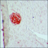 Anti-Glutamic Acid Decarboxylase 65/67 antibody produced in rabbit IgG fraction of antiserum, buffered aqueous solution