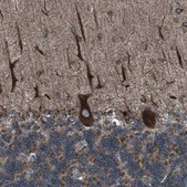 Anti-LNPK antibody produced in rabbit Prestige Antibodies® Powered by Atlas Antibodies, affinity isolated antibody, buffered aqueous glycerol solution