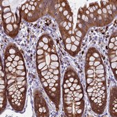 Anti-UBE2G1 antibody produced in rabbit Prestige Antibodies® Powered by Atlas Antibodies, affinity isolated antibody, buffered aqueous glycerol solution
