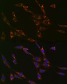 Anti-RPS3 Antibody, clone 3X2M4, Rabbit Monoclonal