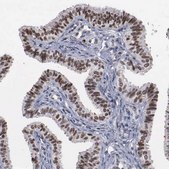 Anti-TRMT5 antibody produced in rabbit Prestige Antibodies® Powered by Atlas Antibodies, affinity isolated antibody, buffered aqueous glycerol solution