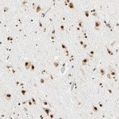 Anti-ZSCAN16 antibody produced in rabbit Prestige Antibodies® Powered by Atlas Antibodies, affinity isolated antibody, buffered aqueous glycerol solution