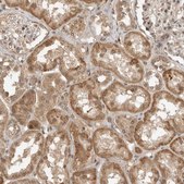Anti-ASPSCR1 antibody produced in rabbit Prestige Antibodies® Powered by Atlas Antibodies, affinity isolated antibody, buffered aqueous glycerol solution