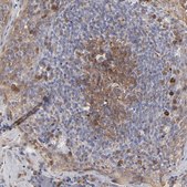 Anti-CASP3 antibody produced in rabbit Prestige Antibodies® Powered by Atlas Antibodies, affinity isolated antibody, buffered aqueous glycerol solution