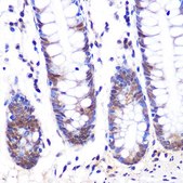 Anti-LXRα antibody produced in rabbit