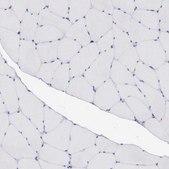 Anti-GRIPAP1 antibody produced in rabbit Ab2, Prestige Antibodies® Powered by Atlas Antibodies, affinity isolated antibody, buffered aqueous glycerol solution