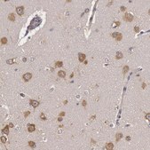 Anti-NMT2 antibody produced in rabbit Prestige Antibodies® Powered by Atlas Antibodies, affinity isolated antibody, buffered aqueous glycerol solution