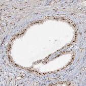 Anti-RBM10 antibody produced in rabbit Prestige Antibodies® Powered by Atlas Antibodies, affinity isolated antibody, buffered aqueous glycerol solution