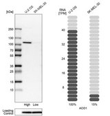 Anti-ACO1 antibody produced in rabbit Prestige Antibodies® Powered by Atlas Antibodies, affinity isolated antibody, buffered aqueous glycerol solution, Ab1